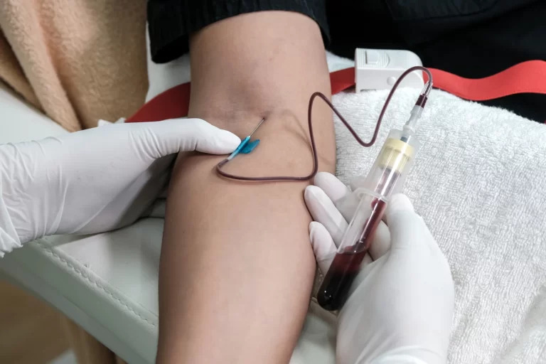 blood draw using butterfly needle
