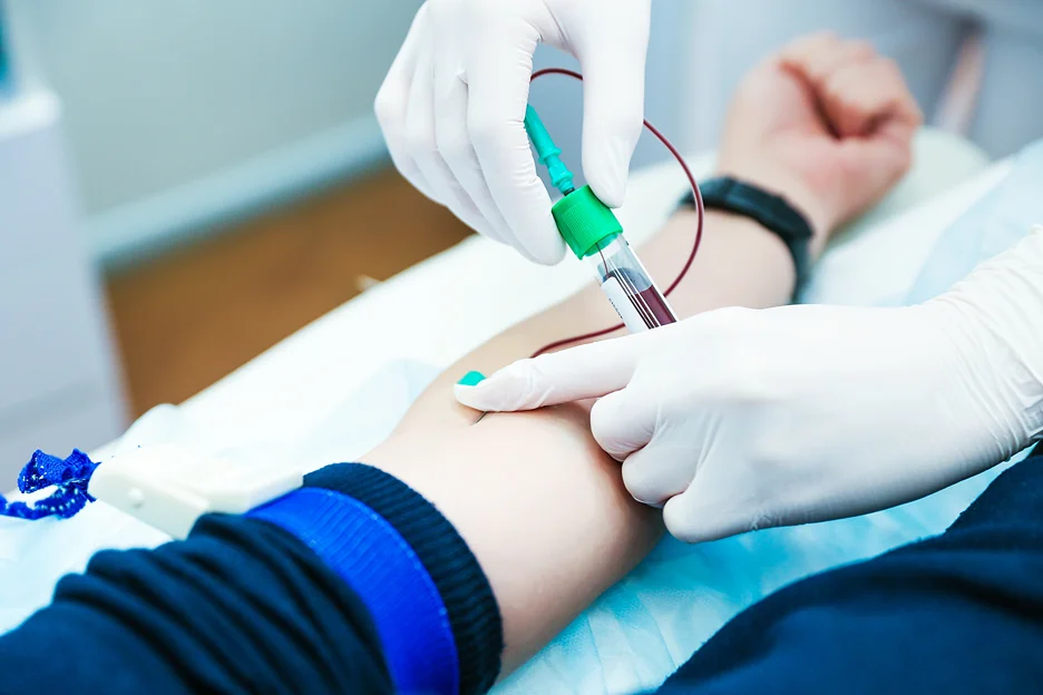 blood draw using butterfly needle