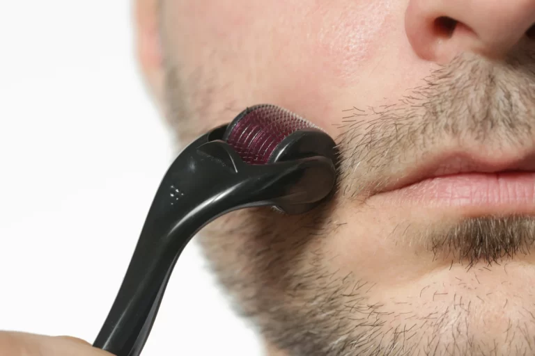 derma roller for beard growth