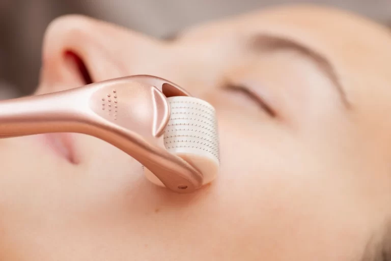 a woman uses derma roller on her face