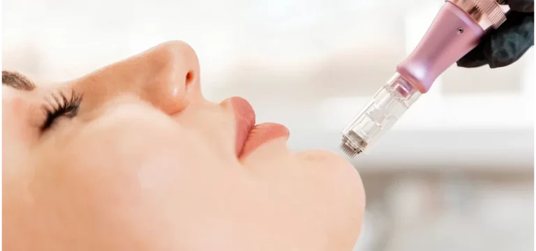 exosomes microneedling