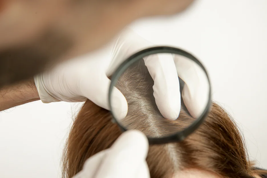 a doctor checks the patient's exosome therapy outcome on the hair