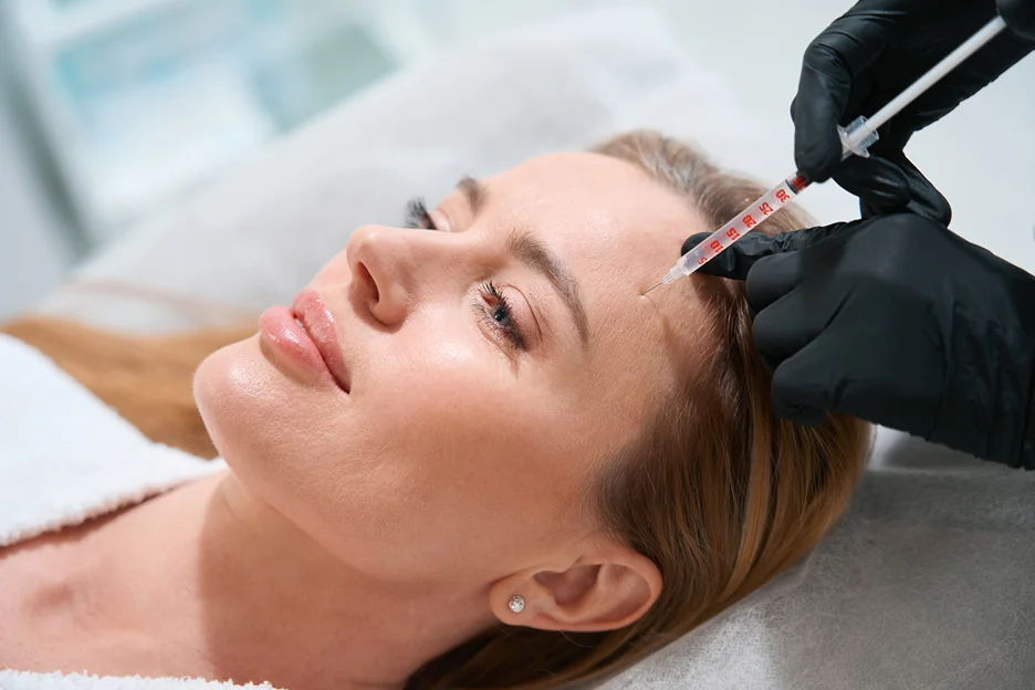 a woman gets exosome therapy on her forehead wrinkles