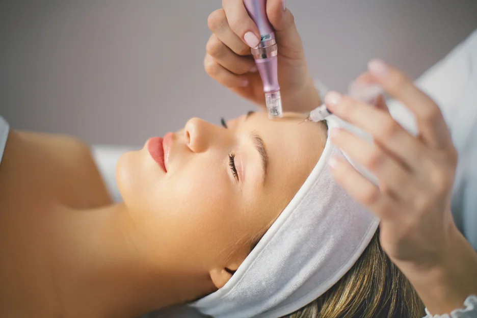 a woman had microneedling and pdrn treatments