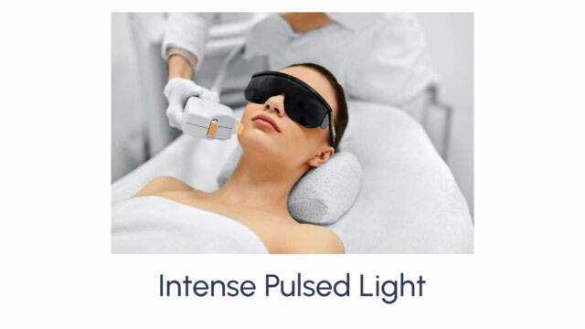 Intense Pulsed Light (IPL) - Image 4