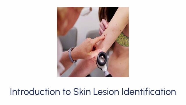 Introduction to Skin Lesion Identification - Image 4