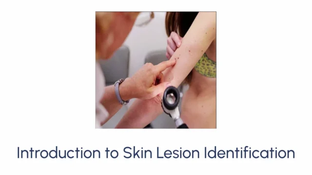 Introduction to Skin Lesion Identification - Image 2