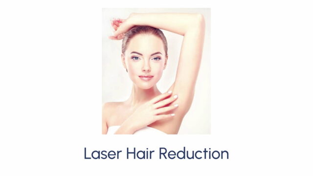 Laser Hair Reduction - Image 4