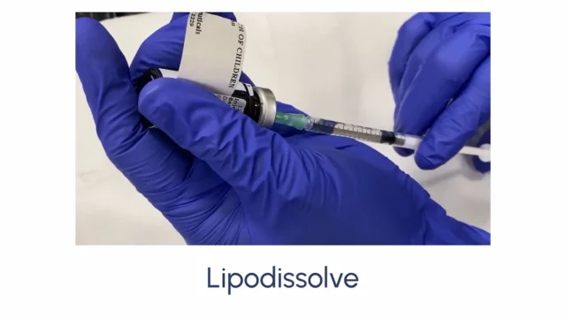 Lipodissolve - Image 2