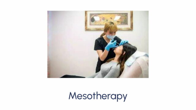 Mesotherapy - Image 2