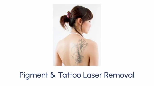 Pigment & Tattoo Laser Removal - Image 2