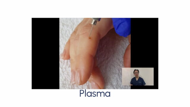 Plasma - Image 4
