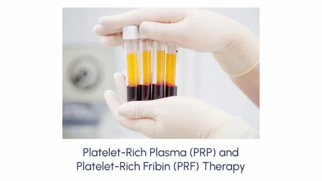 Platelet-Rich Plasma (PRP) And Platelet-Rich Fribin (PRF) Therapy - Image 2