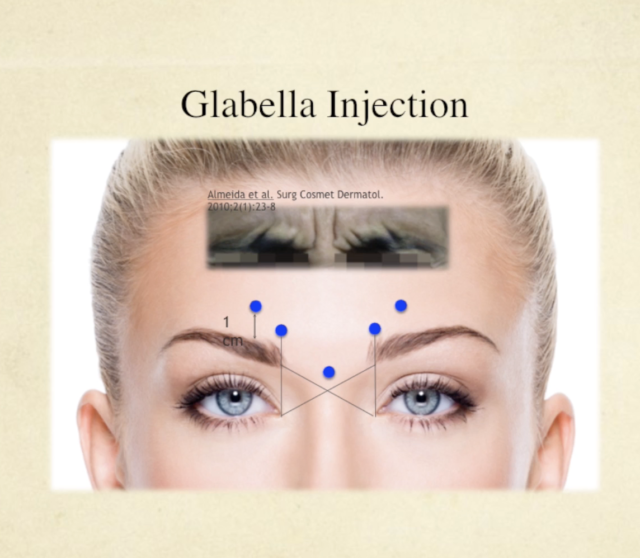 Facial Neuromodulator Injections Course - Image 8