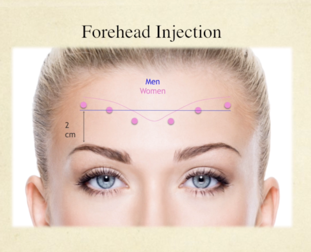 Facial Neuromodulator Injections Course - Image 6
