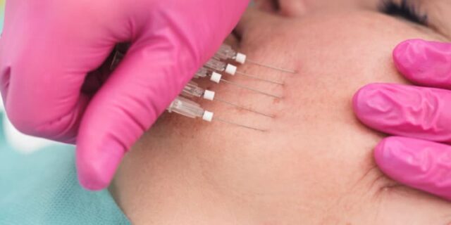 Cosmetic Threads - Mono Threads - Image 2
