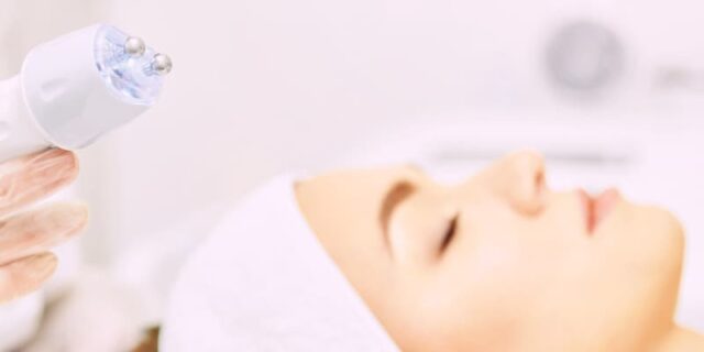 Fractional Radiofrequency - Image 2