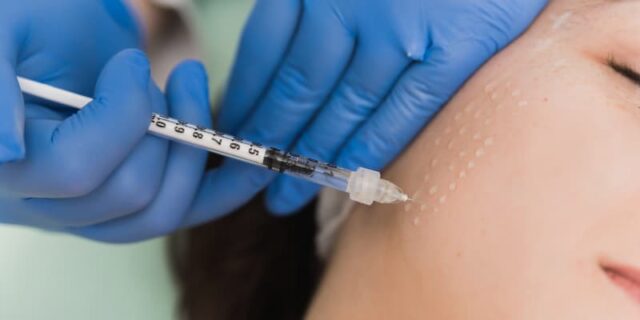 Mesotherapy - Image 3