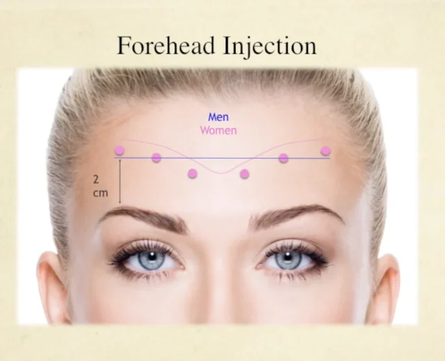 Facial Neuromodulator Injections Course - Image 2