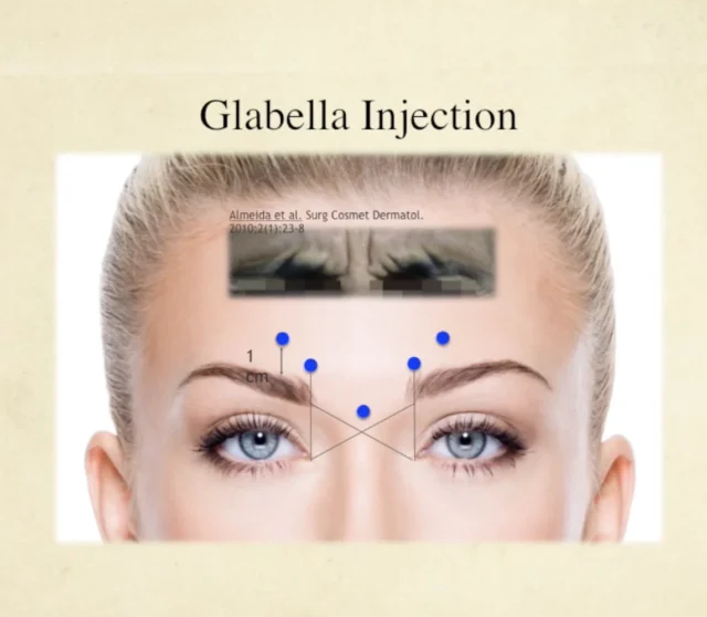 Facial Neuromodulator Injections Course - Image 3