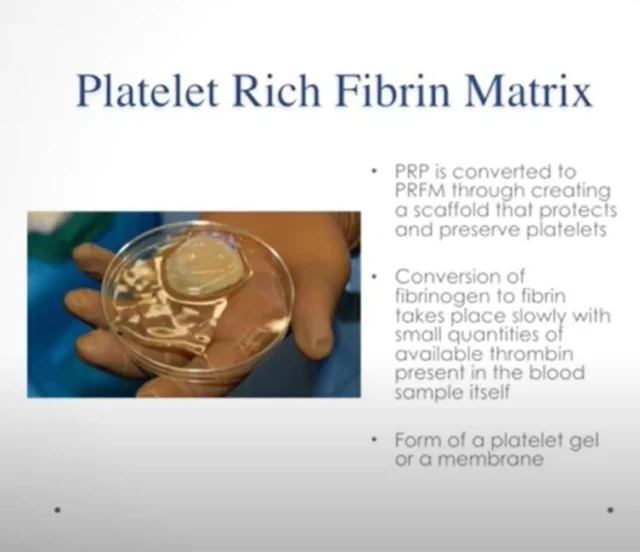 Platelet Rich Plasma (PRP) Platelet Rich Fibrin Matrix (PRFM) in Regenerative Medicine Video Course - Image 3