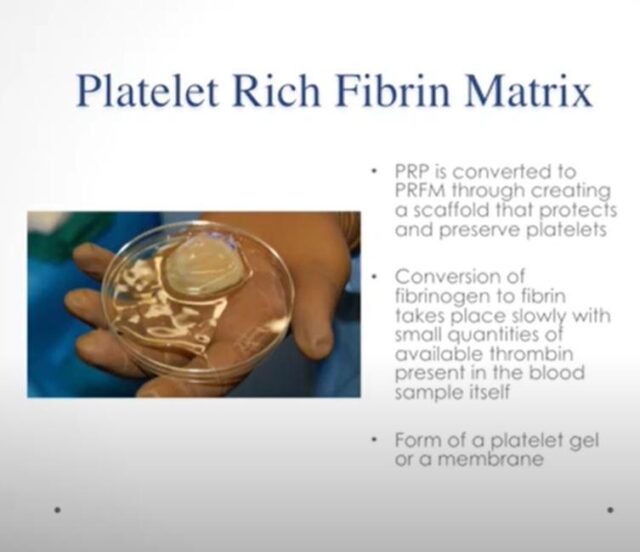 Platelet Rich Plasma (PRP) Platelet Rich Fibrin Matrix (PRFM) in Regenerative Medicine Video Course - Image 7