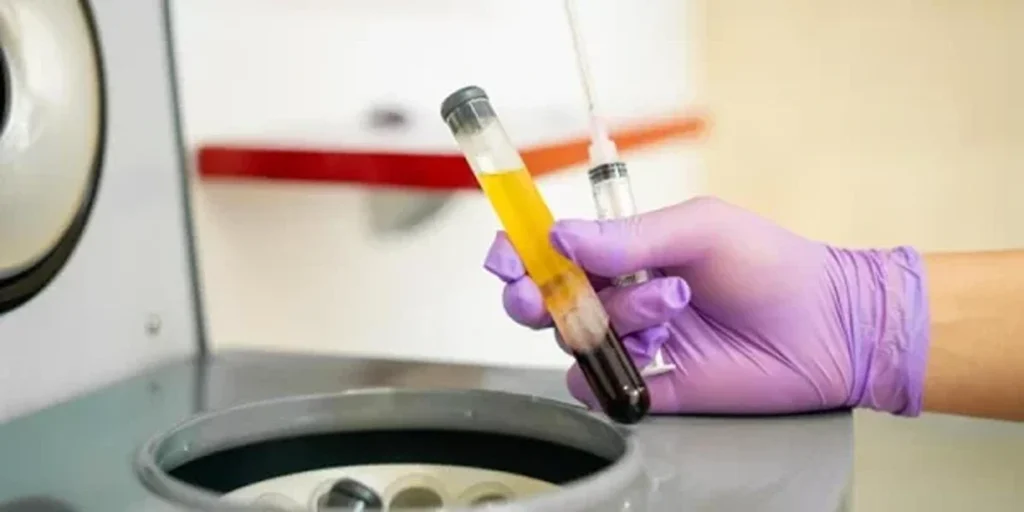 What Is The Best PRP Kit