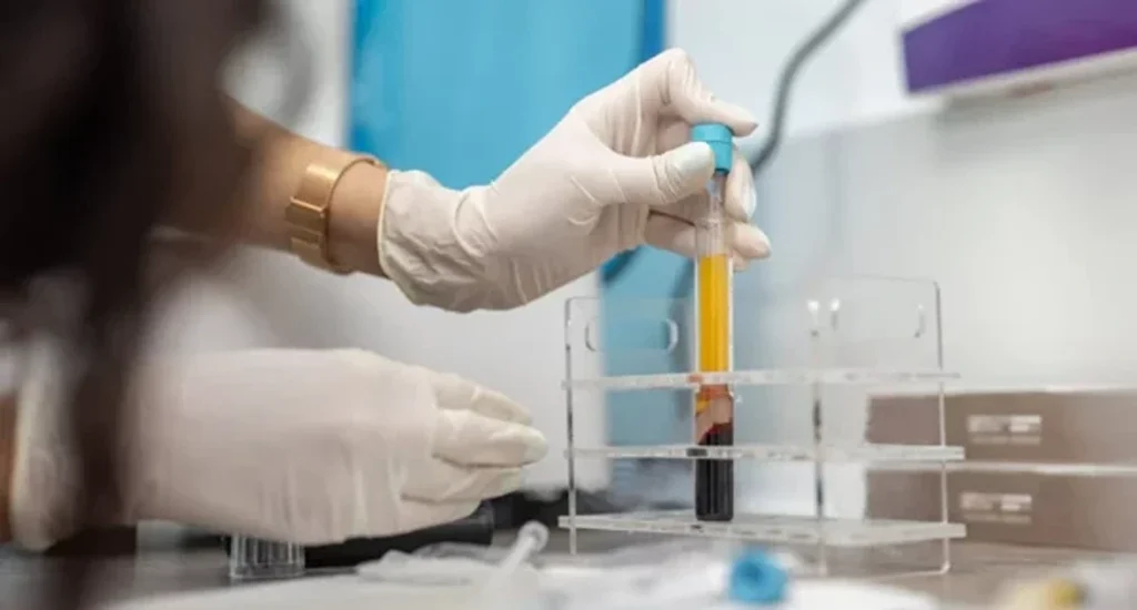 Where Does Platelet Rich Plasma Come From For PRP Therapy Injections