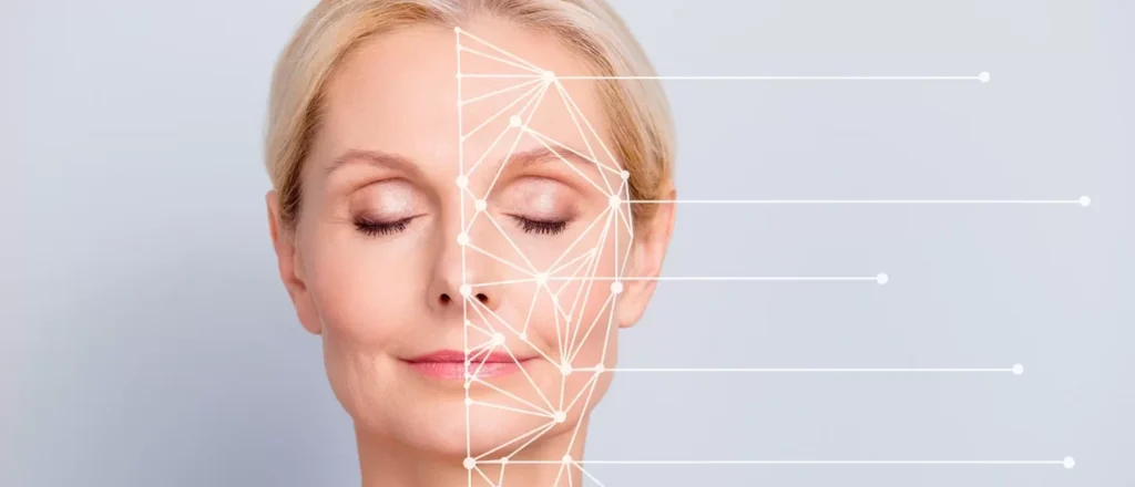 A woman's face with lines indicating treatment areas