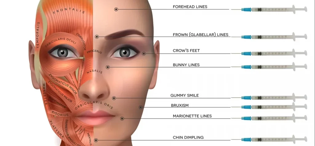 Muscles structure of the female face and neck, each muscle with name on it.
