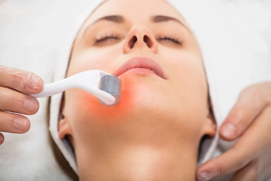 can derma rollers ruin your skin