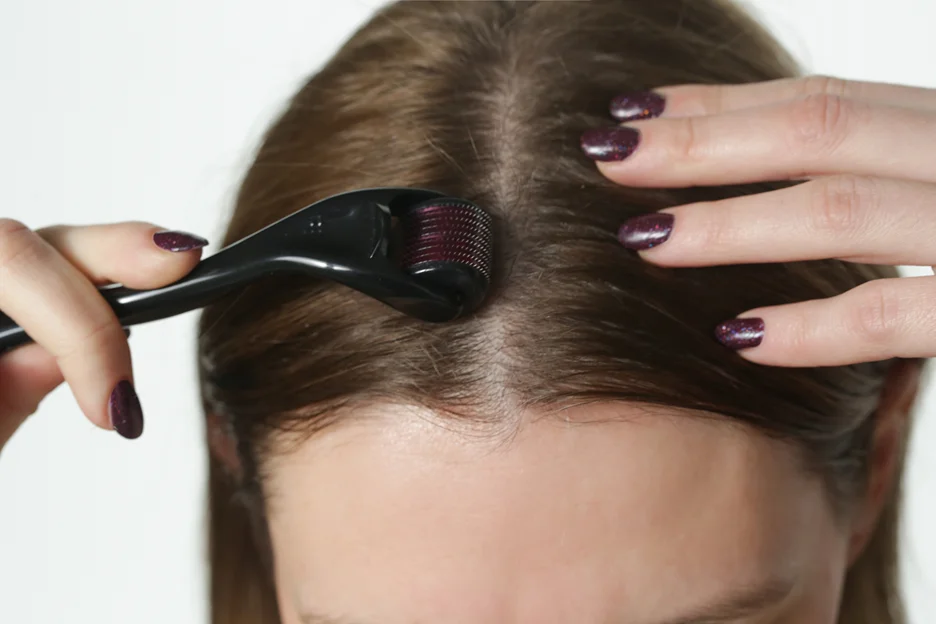 derma roller for hair loss