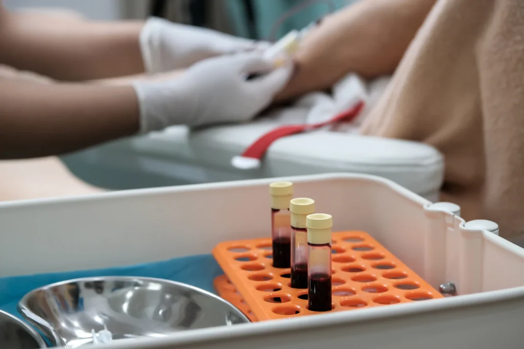 blood collection using butterfly needle