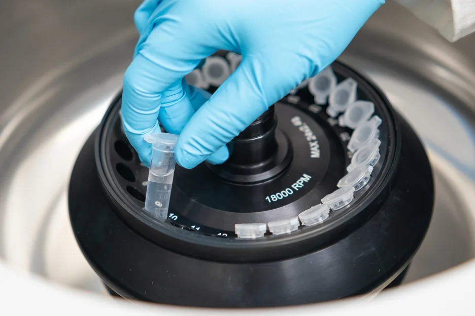 exosomes isolation