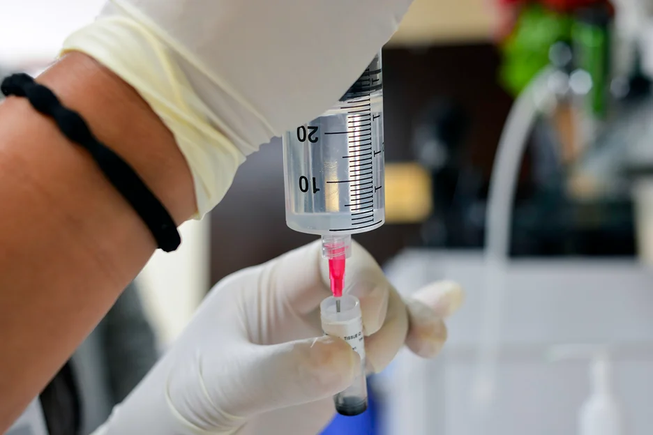 exosomes isolation