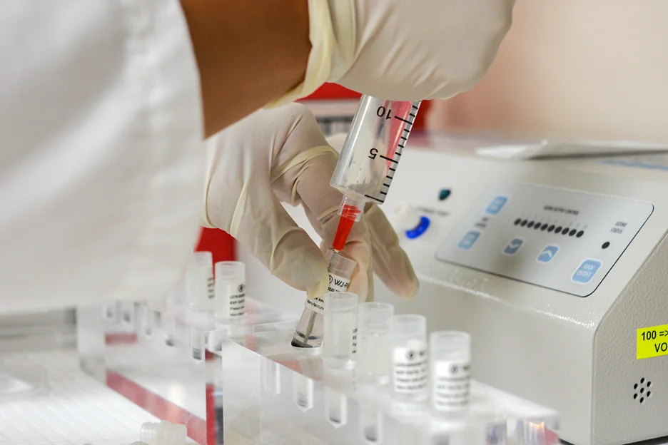 exosomes vs prp