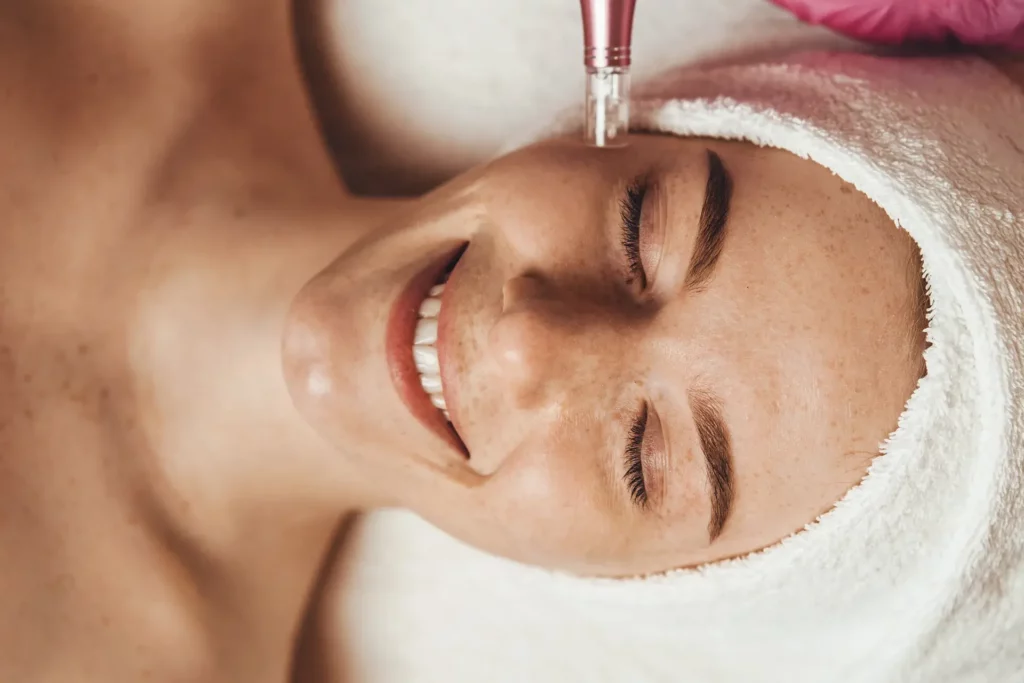 a portrait of a woman received professional microneedling pen treatment inside a med spa