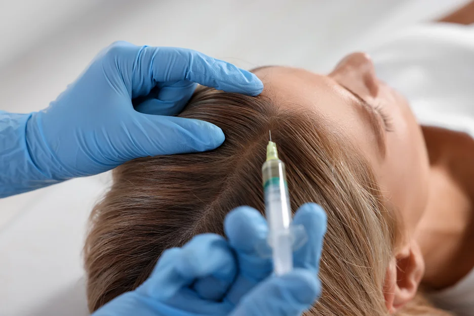 a provider injects exosomes into the patient's scalp